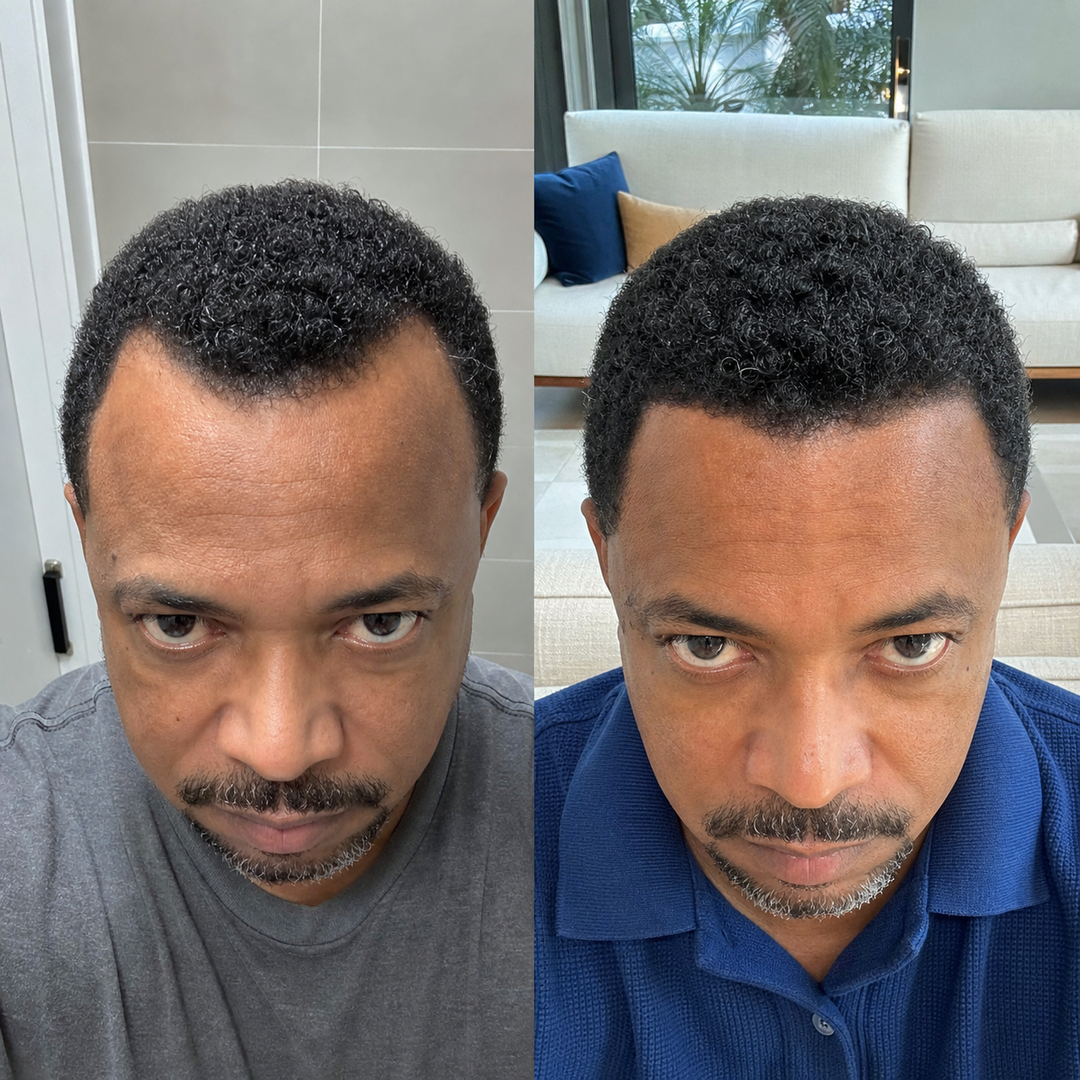 Resultado capilar em cabelo crespo masculino